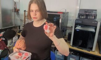 Tehnologii care schimbă medicina, prezentate la UTCN: proteze personalizate, limbă artificială și organe create cu imprimante 3D