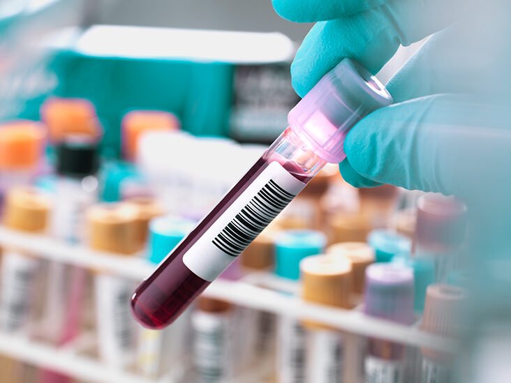 O anumită grupă sanguină pare să prezinte un risc mai mare de diabet de tip 2