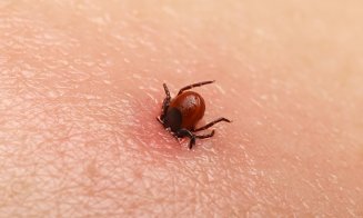 Atenție, a început sezonul căpușelor! Cum să te protejezi și ce să faci dacă ești mușcat
