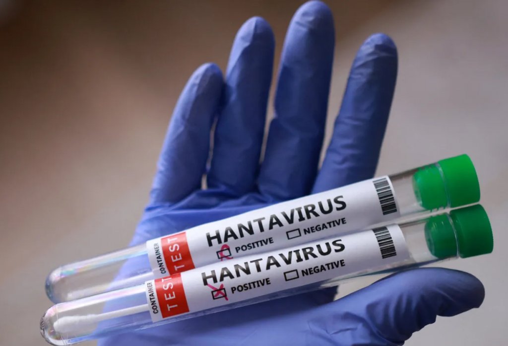 Focarul de hantavirus. Încă un cetățean britanic suspect de infectare/ Stewardesa olandeză nu are virusul