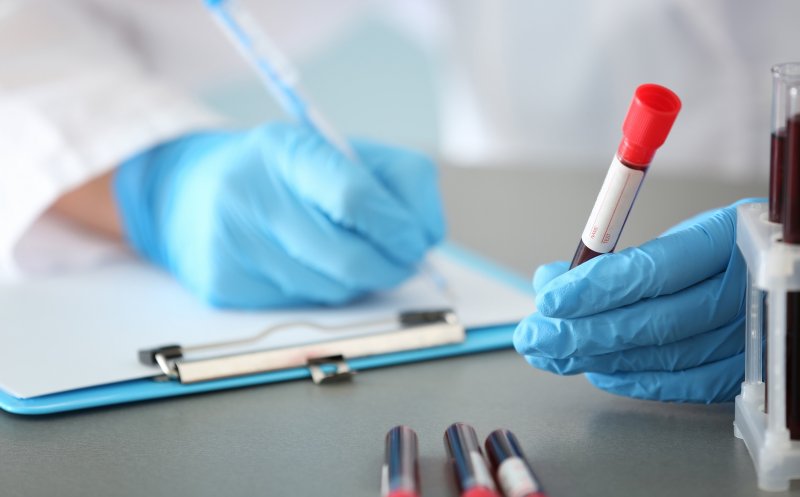 O anumită grupă sanguină pare să prezinte un risc mai mare de diabet de tip 2