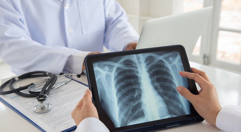 Cancerul pulmonar, terapiile biologice și AI, în centrul unei conferințe de pneumologie la Cluj
